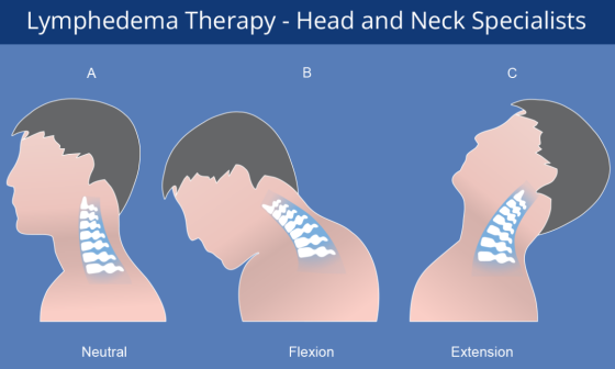 Head and Neck Lymphedema Specialists