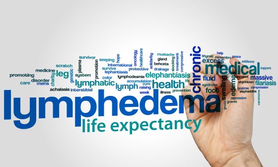 Lymphedema Life Expectancy