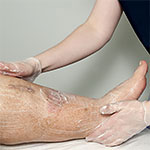 Lymphedema Skincare Course